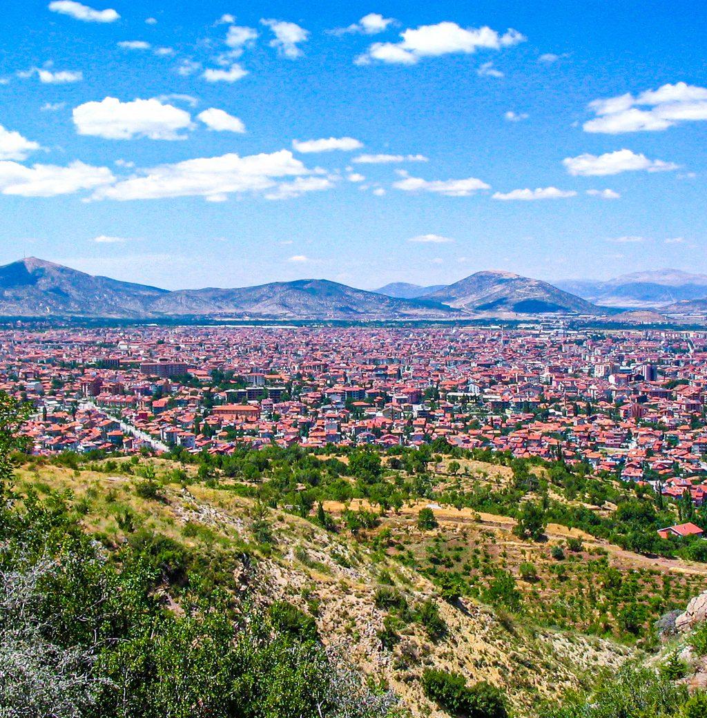 Isparta FUE Saç Ekimi