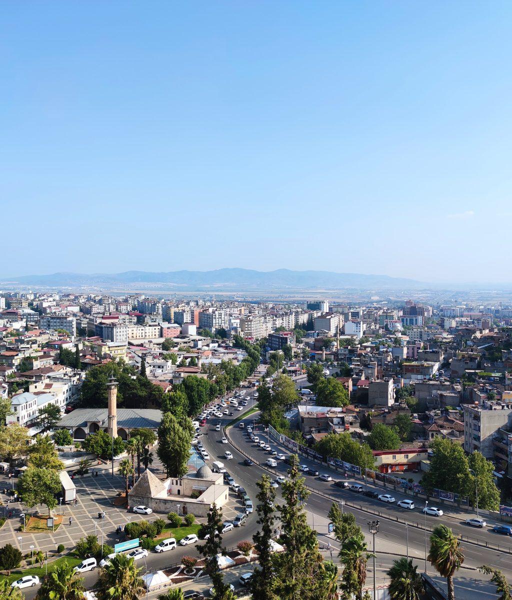 Kahramanmaraş DHI Saç Ekimi